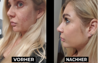 Behandlung