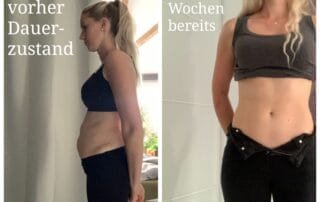Blähbauch vorher nachher